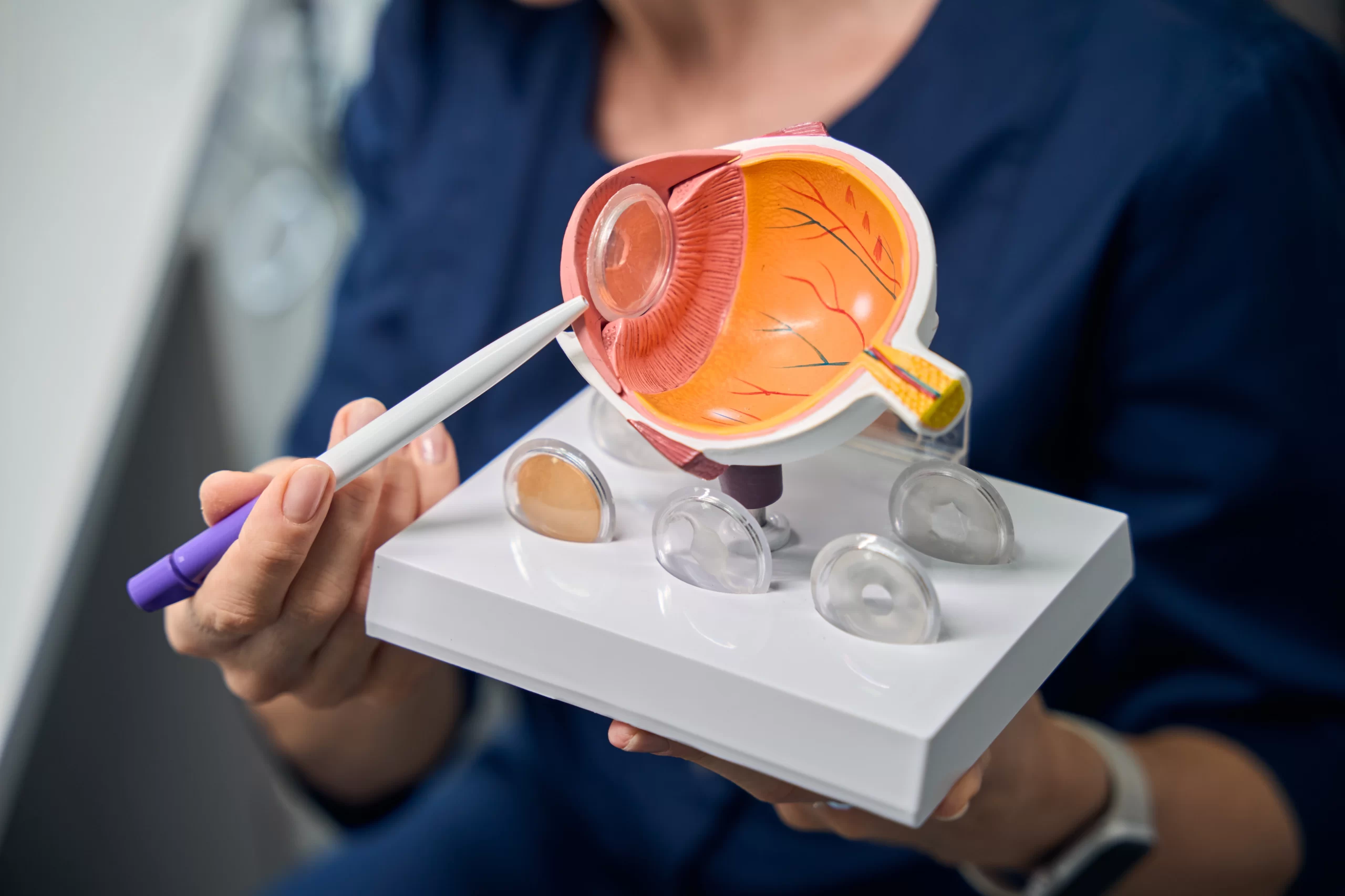 close up of doctor holding an eye model 2025 03 08 17 55 39 utc scaled