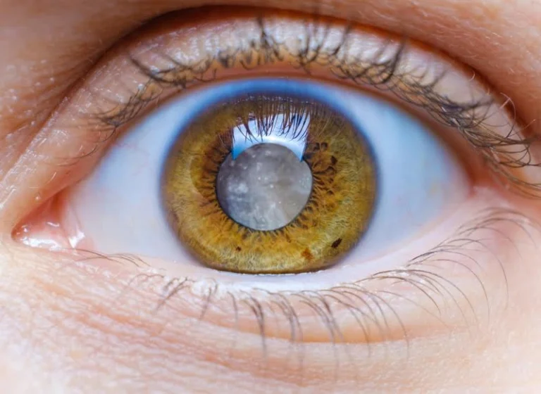 1 todo sobre las cataratas 768x560 1