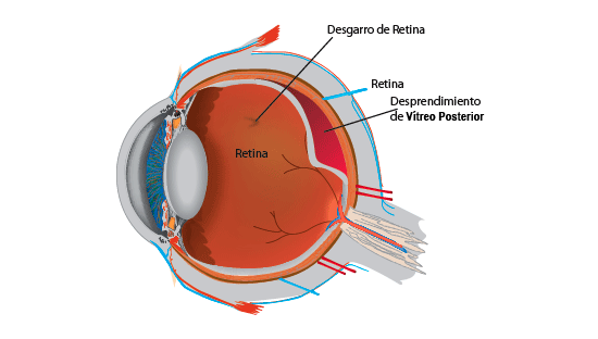 oftalmedic clinica salva vitreo