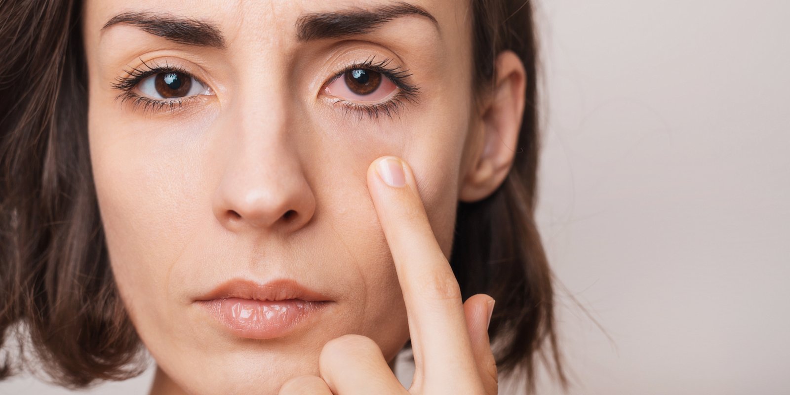 Persona con molestia ocular por ojo seco - Clínica Oftalmológica Lima